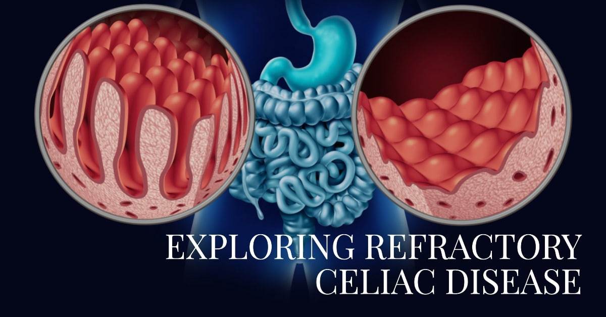 When Gluten-Free Doesn't Cut It Exploring Refractory Celiac Disease - featured blog post image